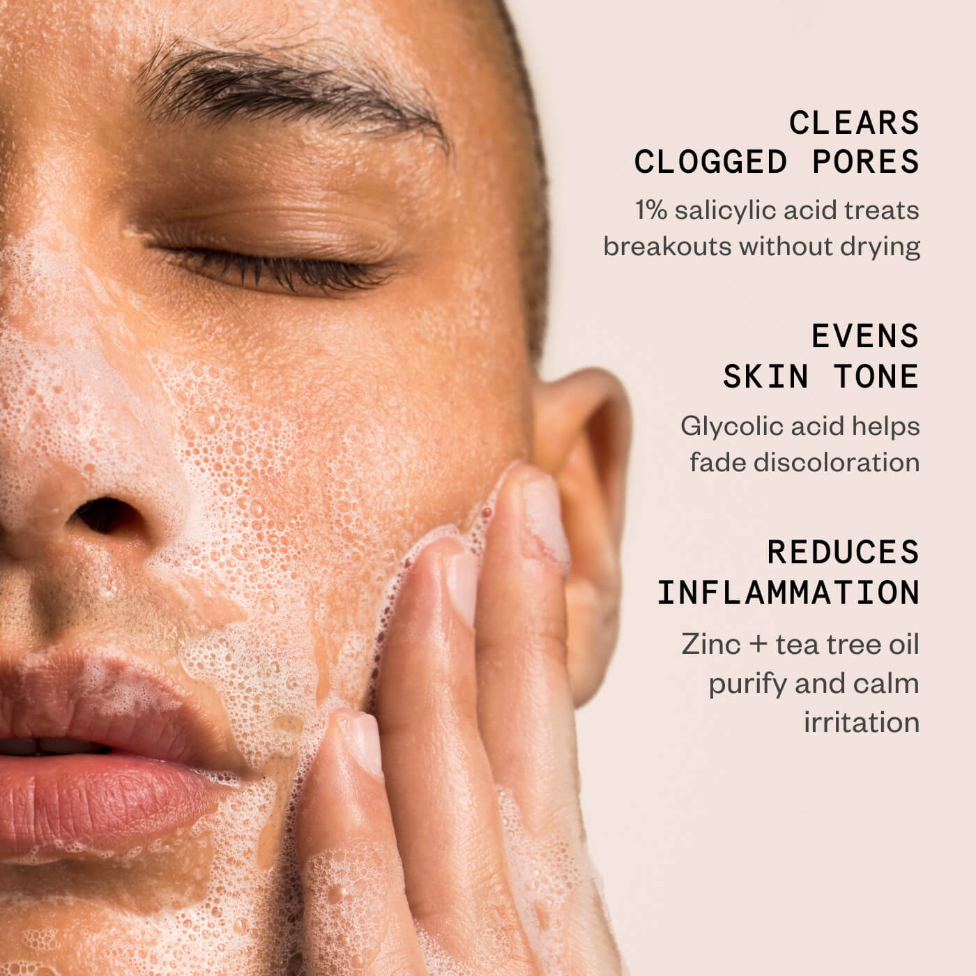 Acne Essentials Duo