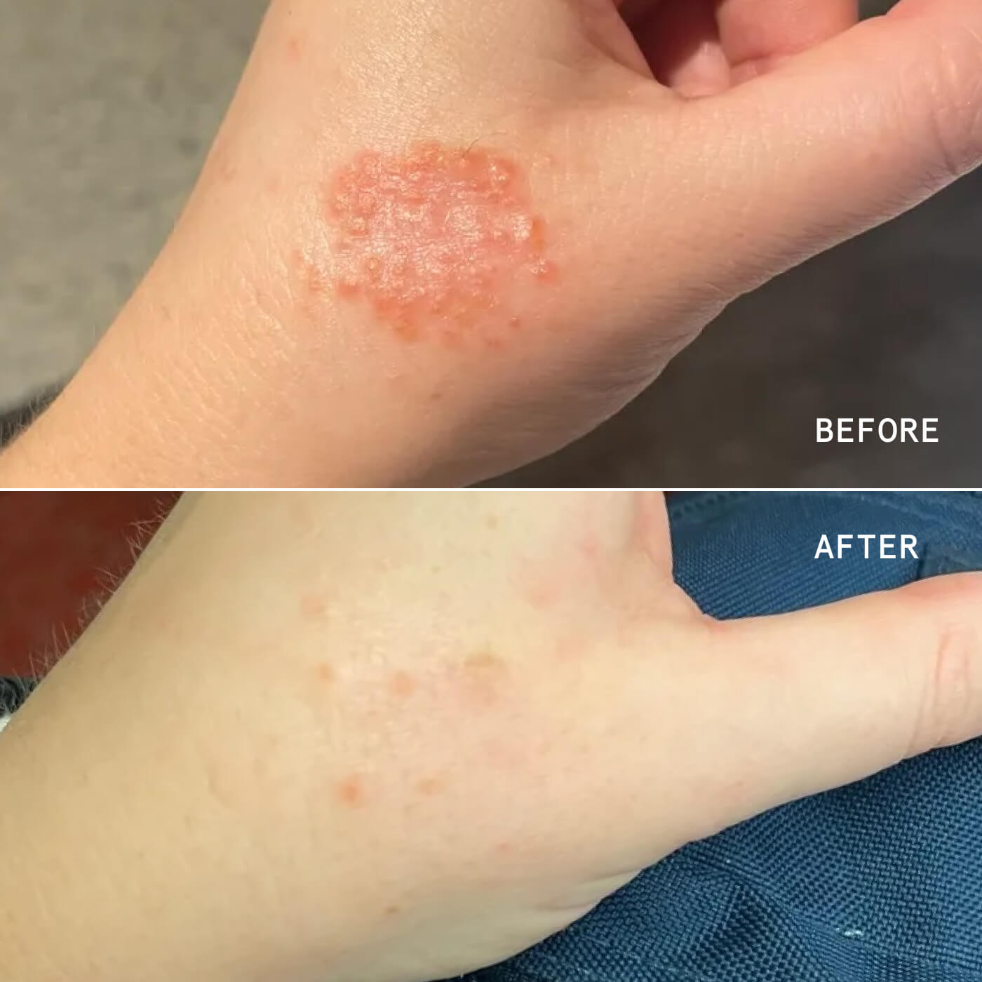 Eczema Relief + Repair Duo