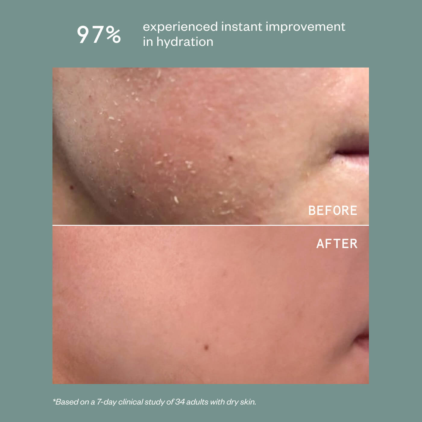 PRECISION HEALING SPRAY
