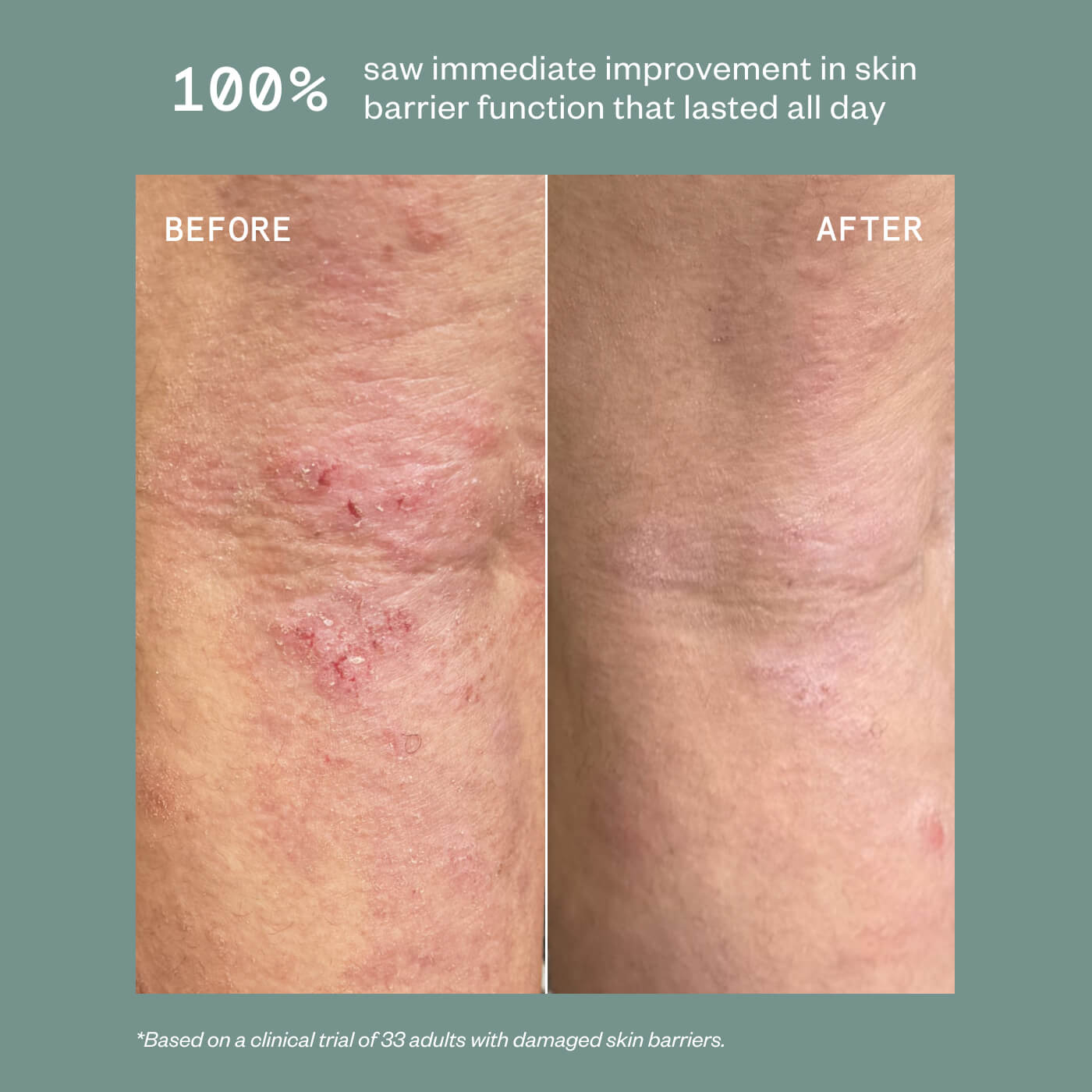 PRECISION HEALING SPRAY