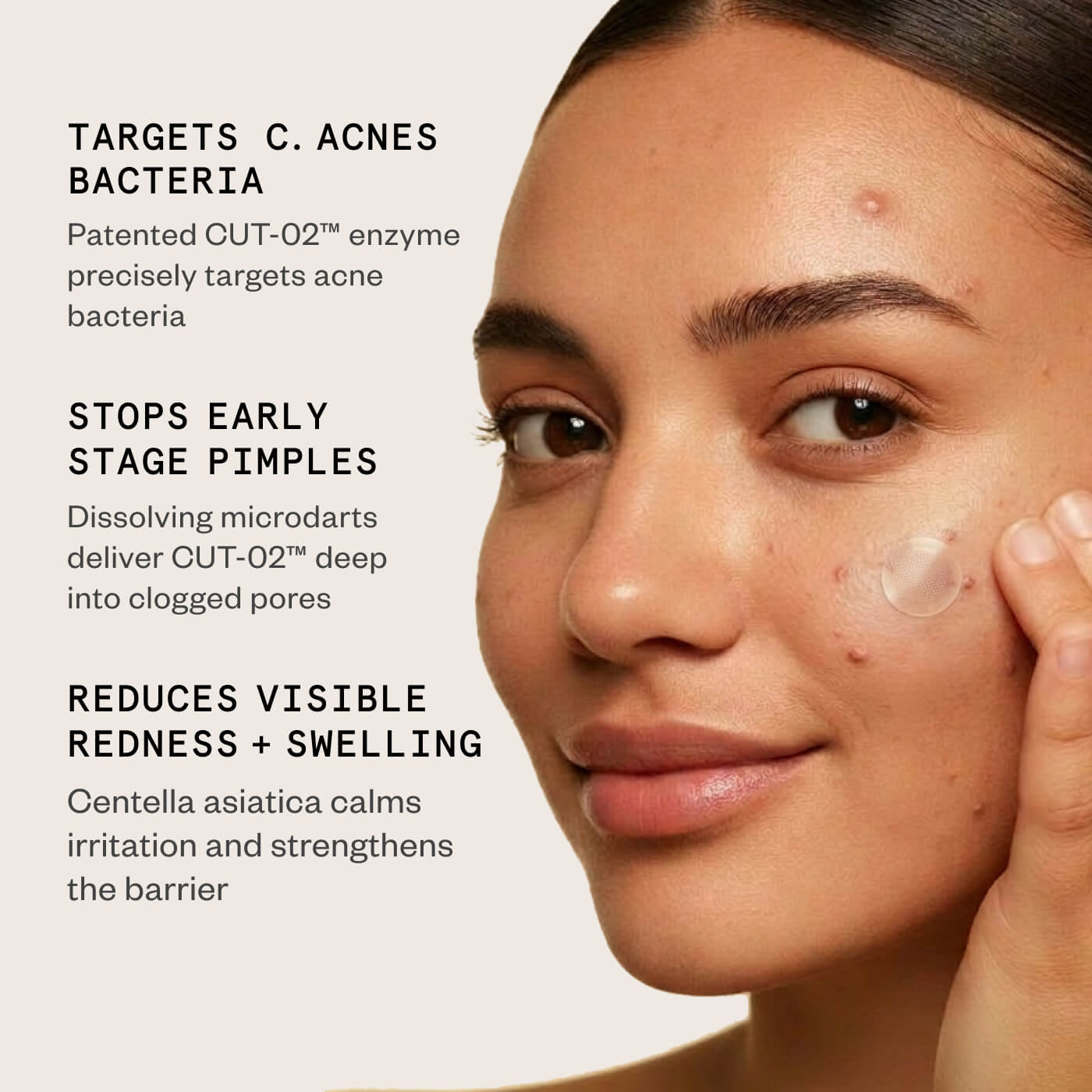 Complete Acne Care Set