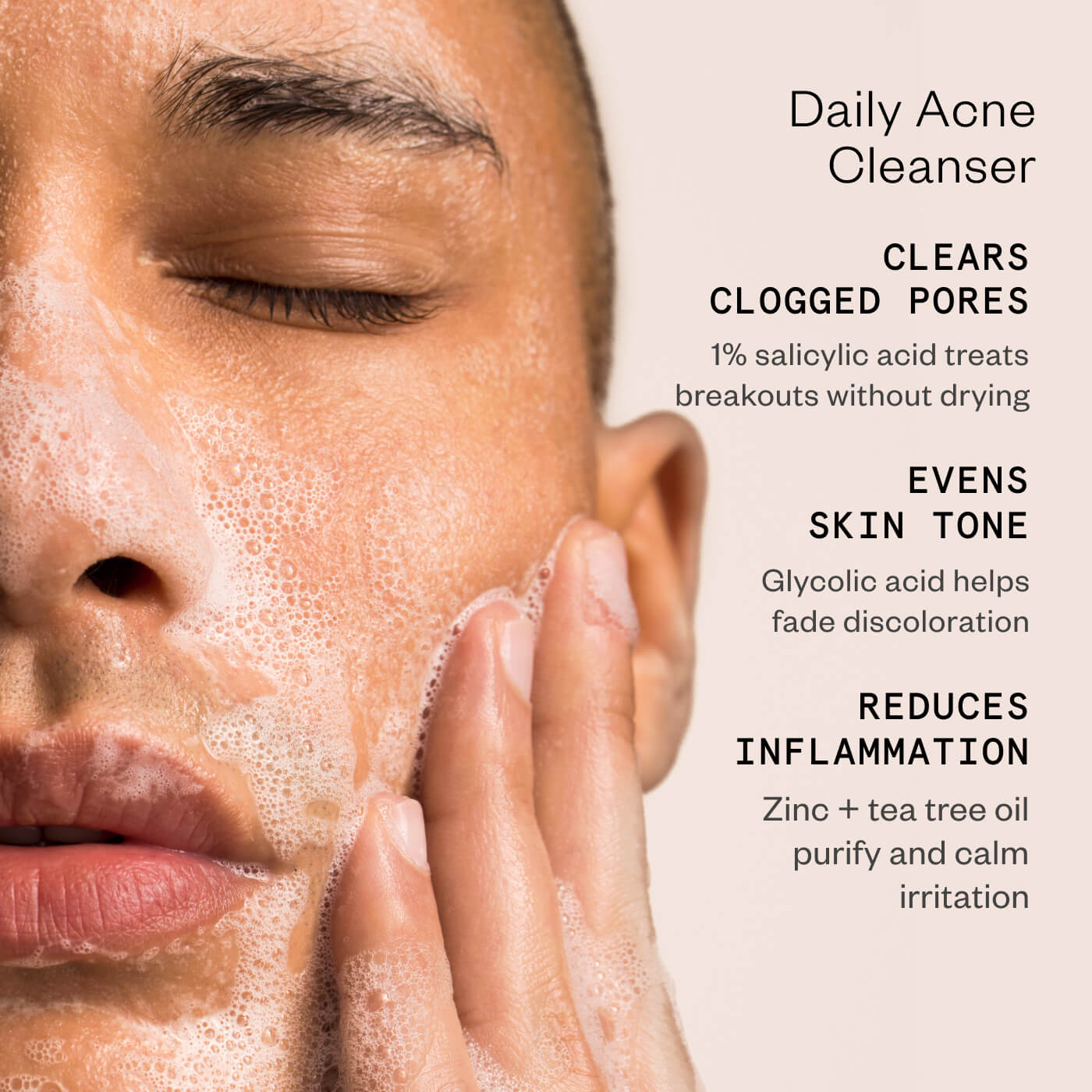 3-Step Precision Acne Routine