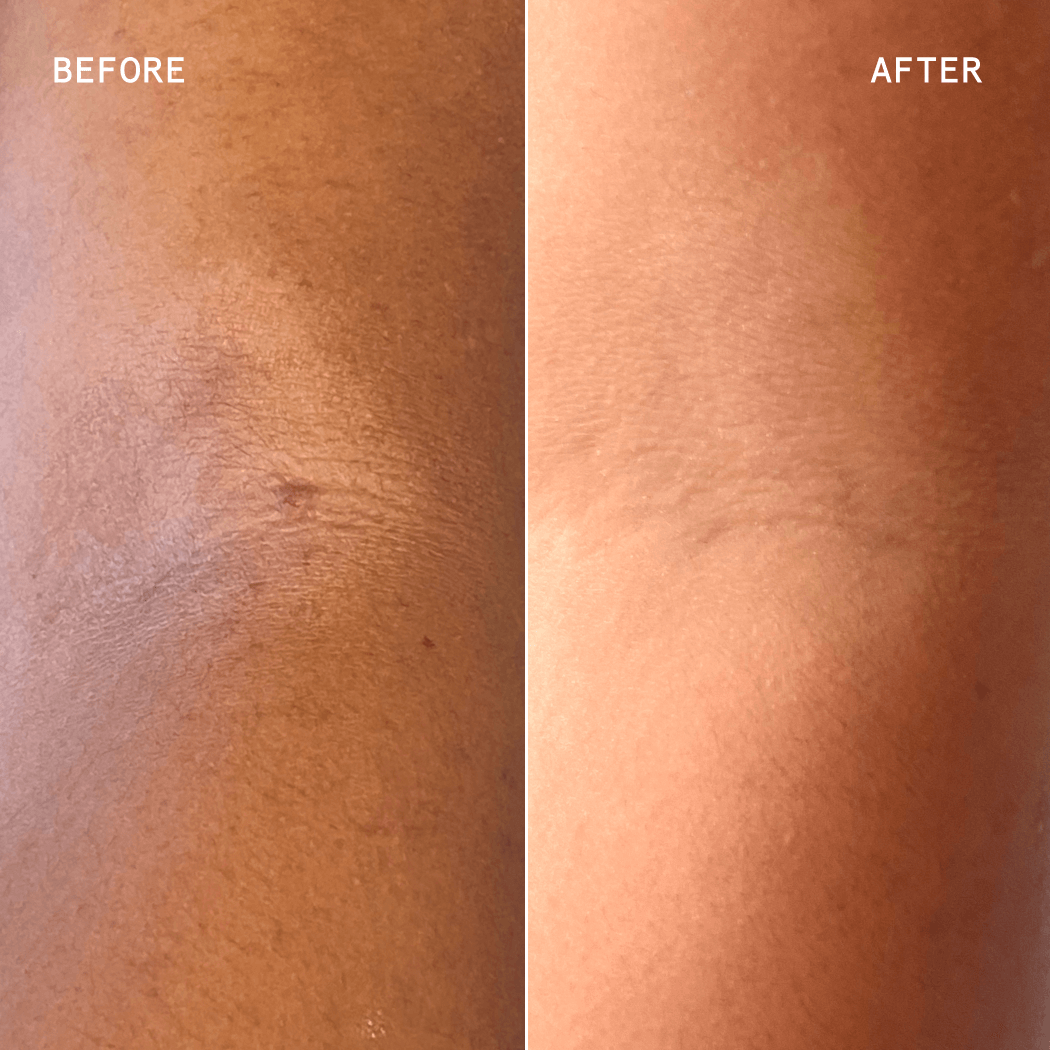 ECZEMA THERAPY CREAM