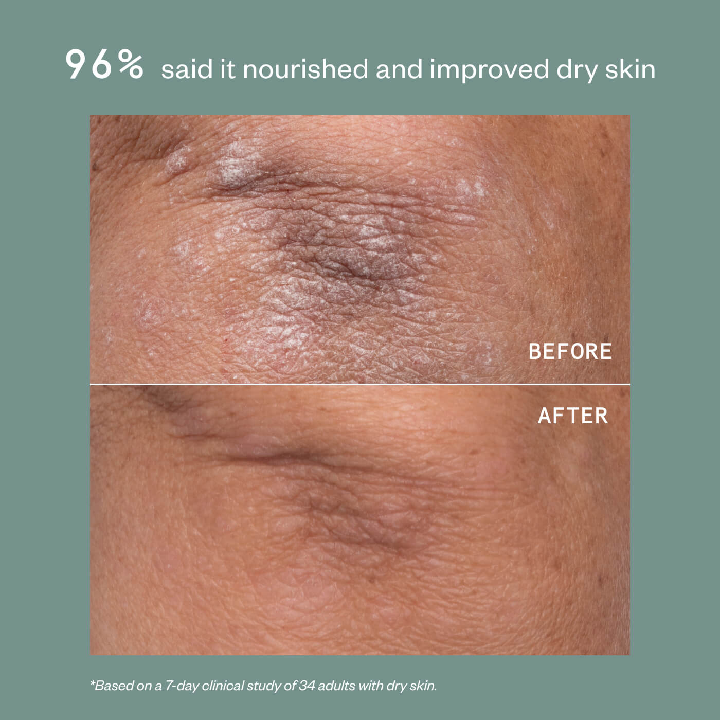 ECZEMA THERAPY CREAM