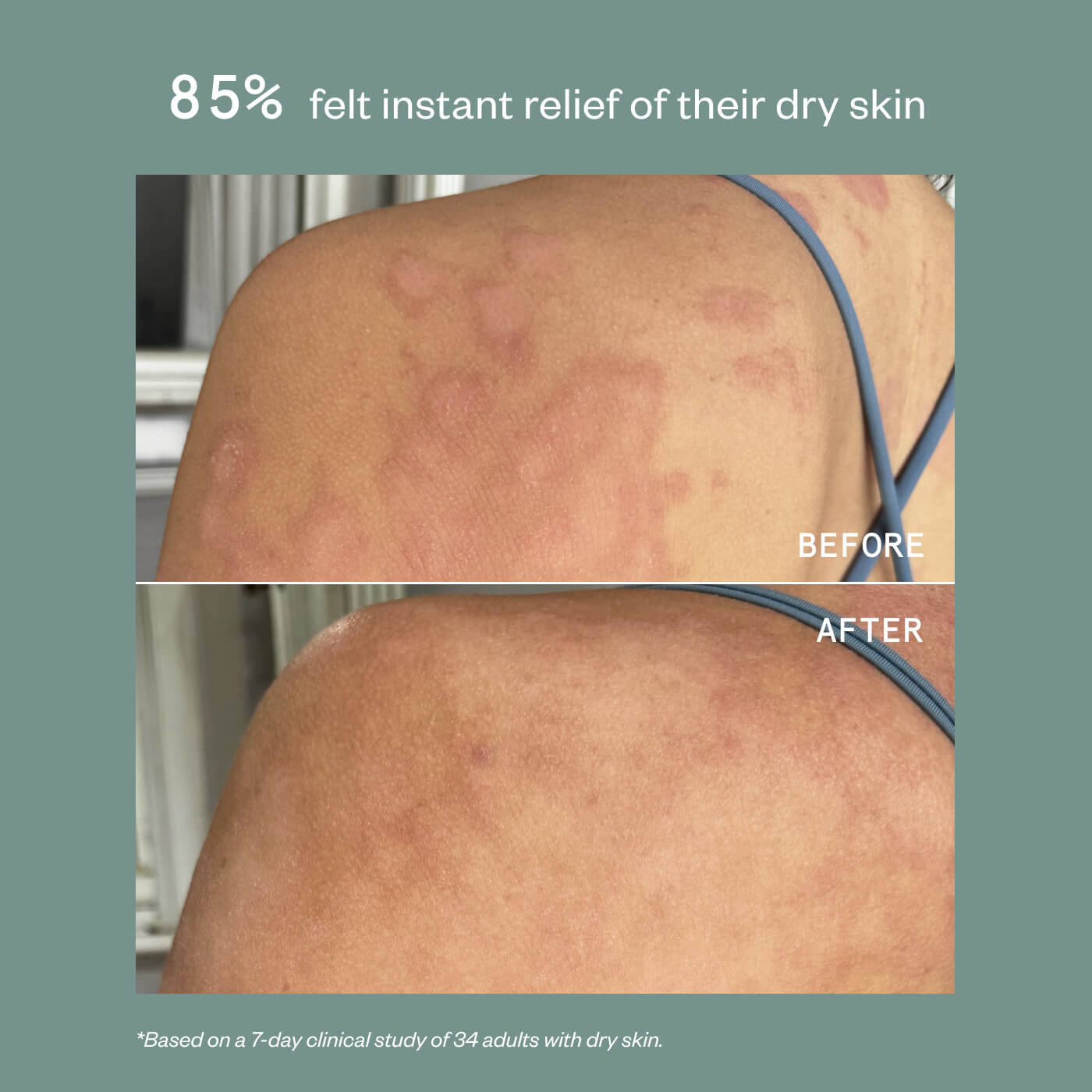 PRECISION HEALING SPRAY