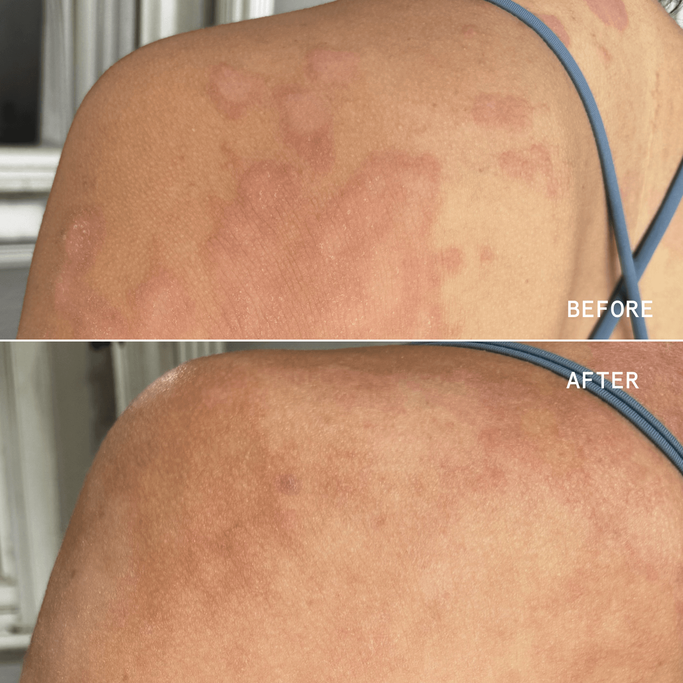 PRECISION HEALING SPRAY