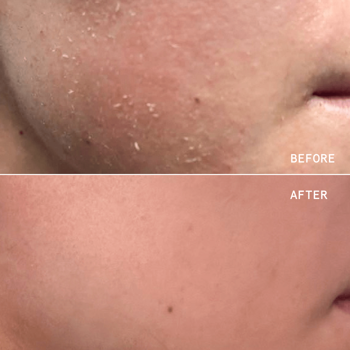PRECISION HEALING SPRAY